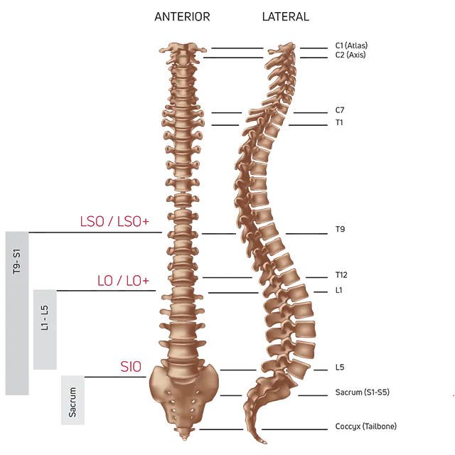 Donjoy ISO Form LO Back Brace